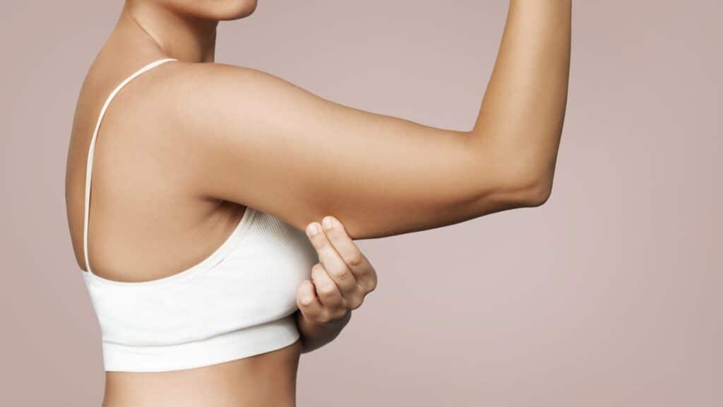 Woman pinching upper arm to show loose skin, ideal candidate for BodyTite skin tightening after weight loss