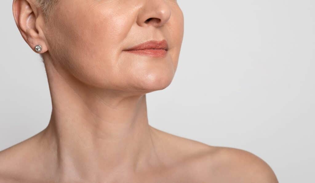 Lower face and neck of mature woman showing smooth skin and defined jawline after FaceTite treatment
