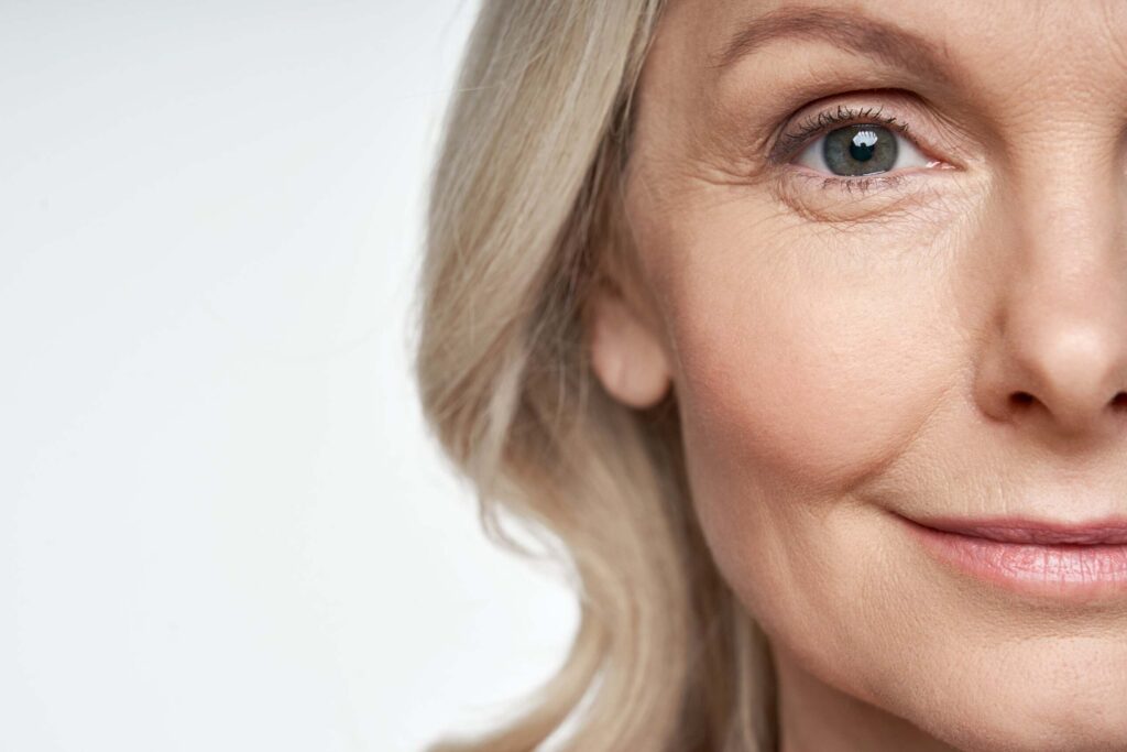 Close-up of a mature woman's lower face showing fine lines and skin texture before AccuTite treatment