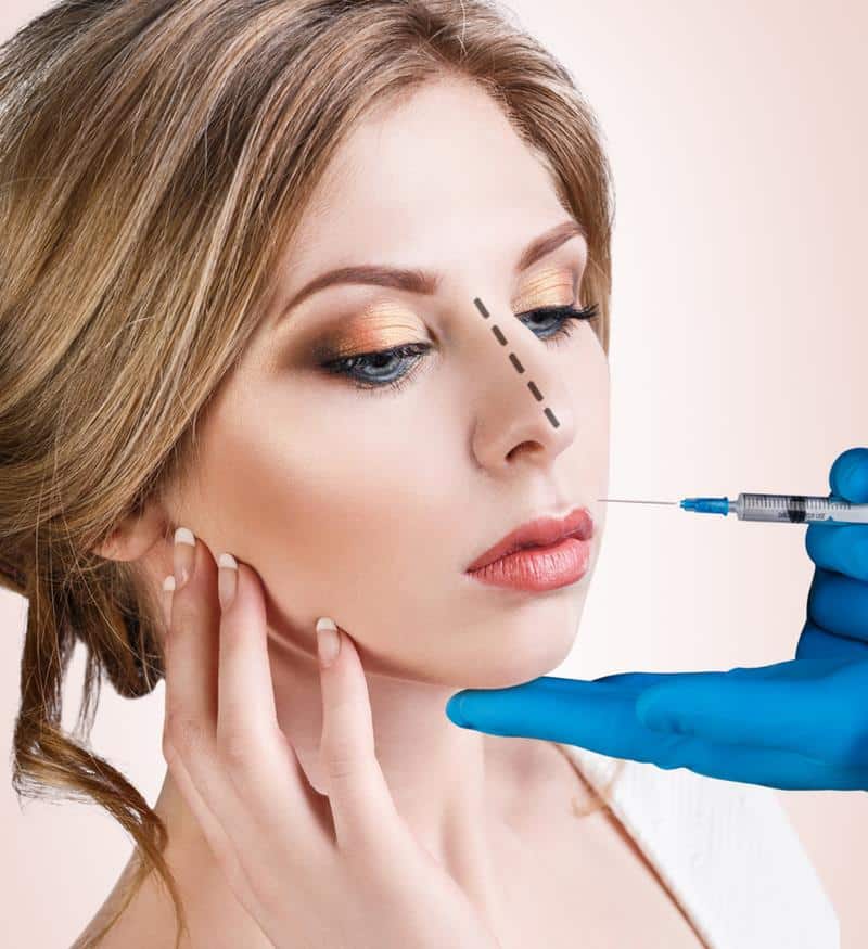 Dermal Fillers in Chicago, IL