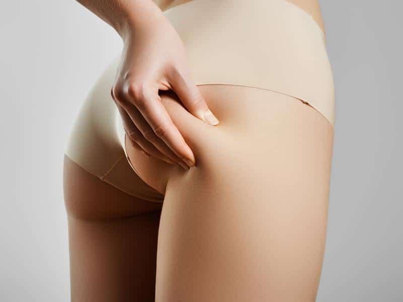 Non-Surgical Butt Lift in Chicago, IL