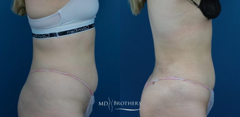 Copy-of-Copy-of-Untitled-Design-768x377