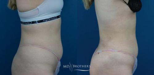 Copy-of-Copy-of-Untitled-Design-768x377